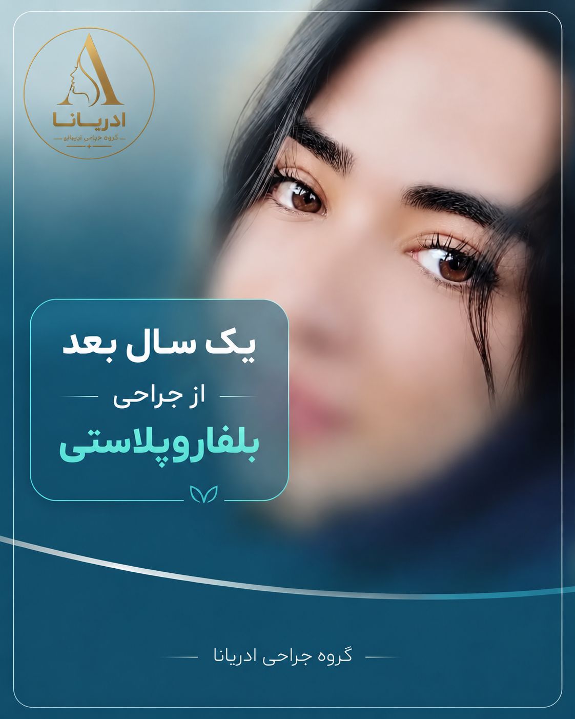بلفاروپلاستی